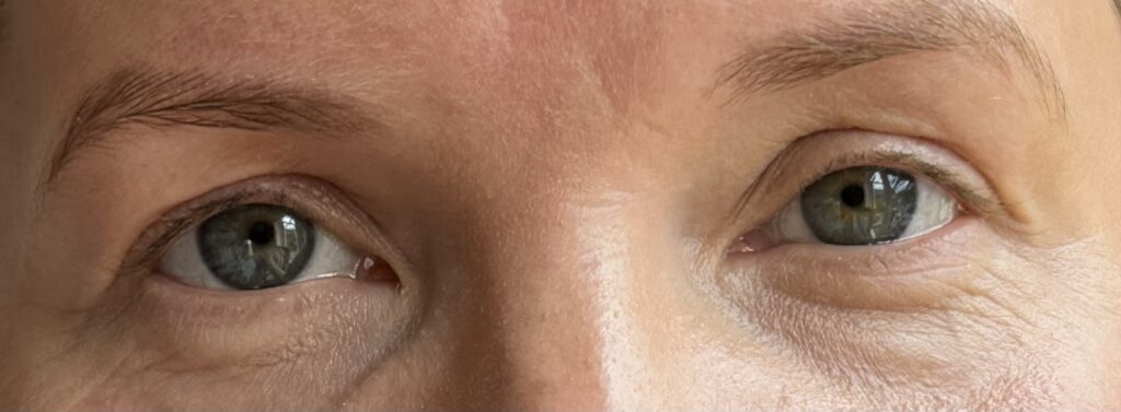Applied to one eye the Milk Makeup Future Fluid Creamy Concealer to show the difference