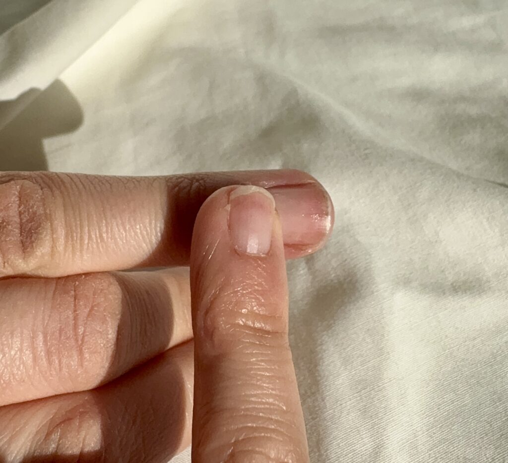 Easy of treating nails