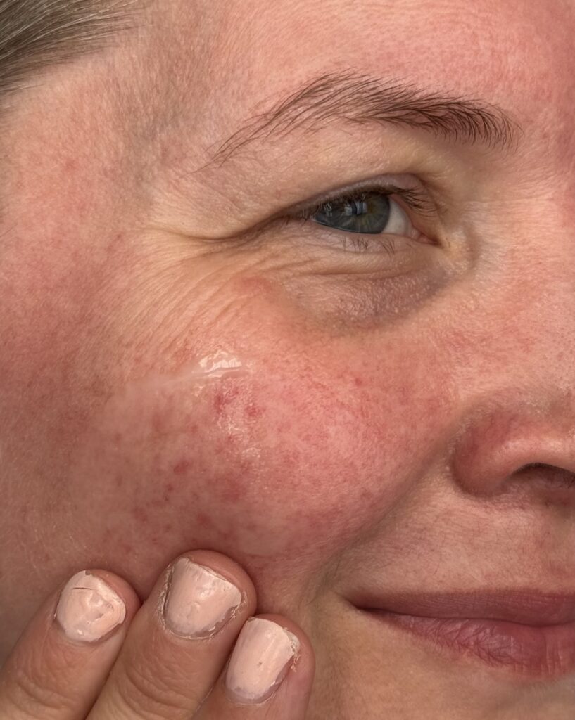 Applying the serum directly onto the skin