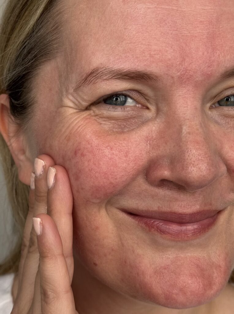 Massging the serum in