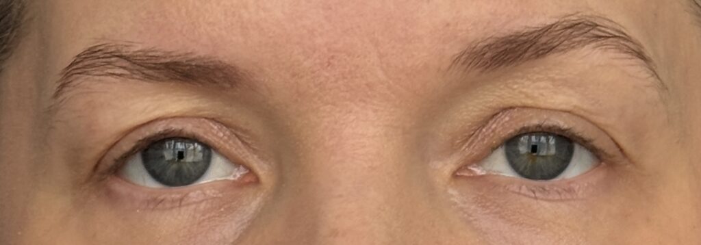 Showing eyes before