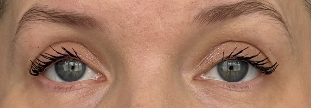Applied to both eyes